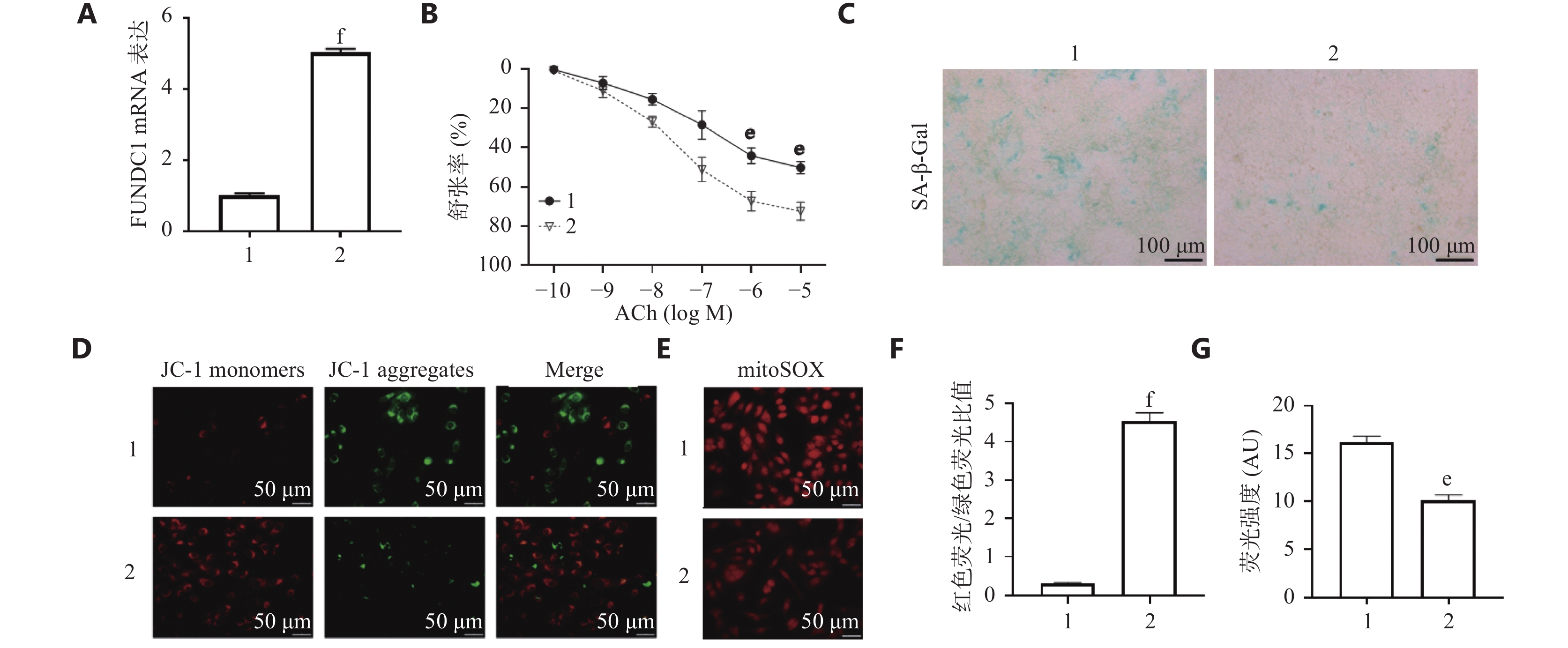 对照小鼠和老龄小鼠CMECs JC-1和mitoSOX免疫荧光染色( × 200) 结果